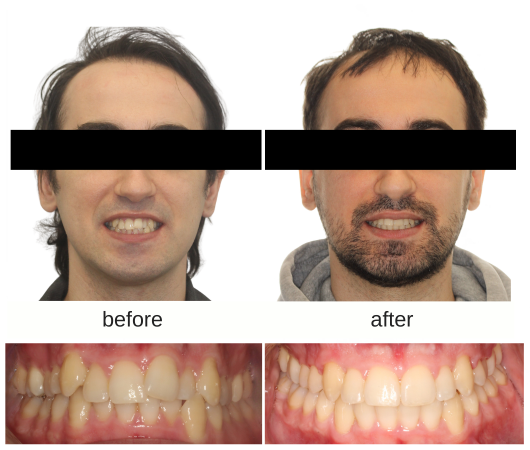 IPR image 1