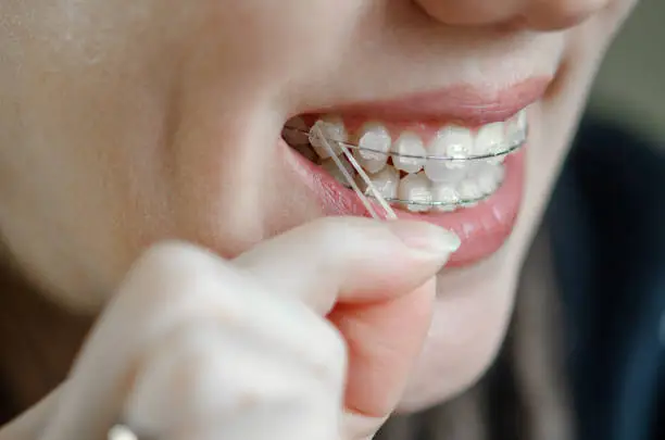 Elastics