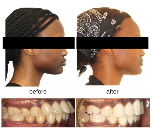 Patient smile