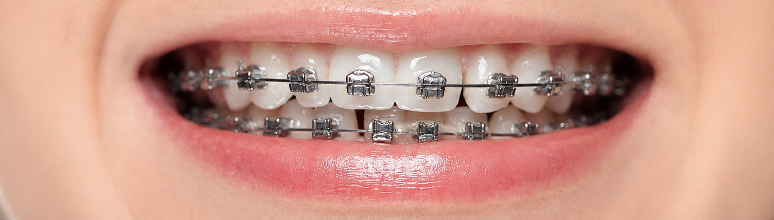 Elastics Banner